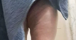 Otelde atesli fantezi 4d66559460d42b3896ca598f744bd5eb Porno, Porno İzle, Mobil Porno, Sikiş, Türk Porno, Rokettube